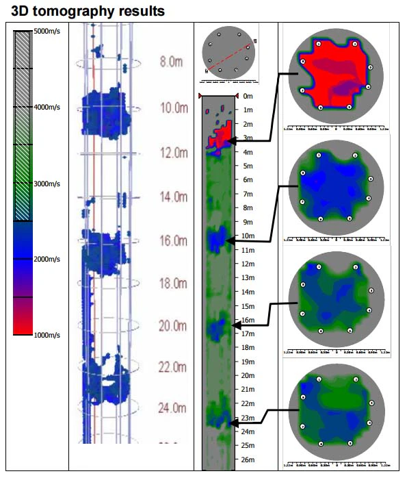 Moniteur à ultrasons à trous croisés